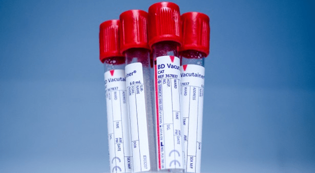 Castle Biosciences stock jumps after FDA grants Breakthrough Device status to melanoma test