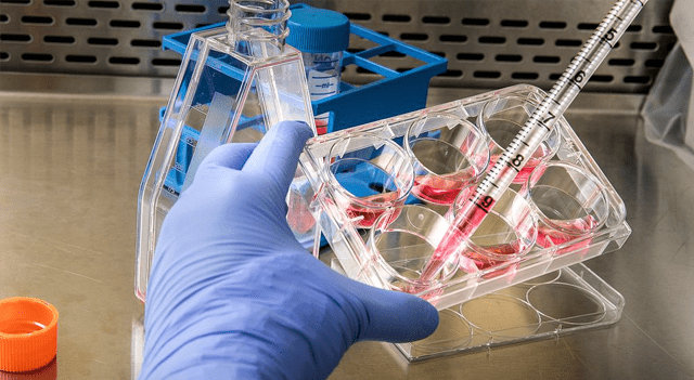 SciSparc’s NeuroThera Labs reports publication of international patent application