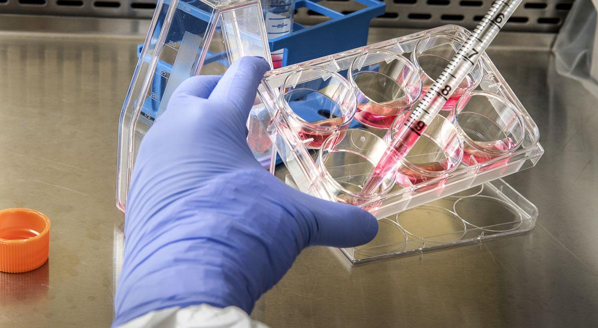 Abivax Shares Tumble Despite Strong Ulcerative Colitis Trial Results as Safety Concerns Emerge (ABVX)