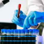 Kala Bio Targets Near-Term Revenue With Virotek Ophthalmology Genetic Testing Partnership
