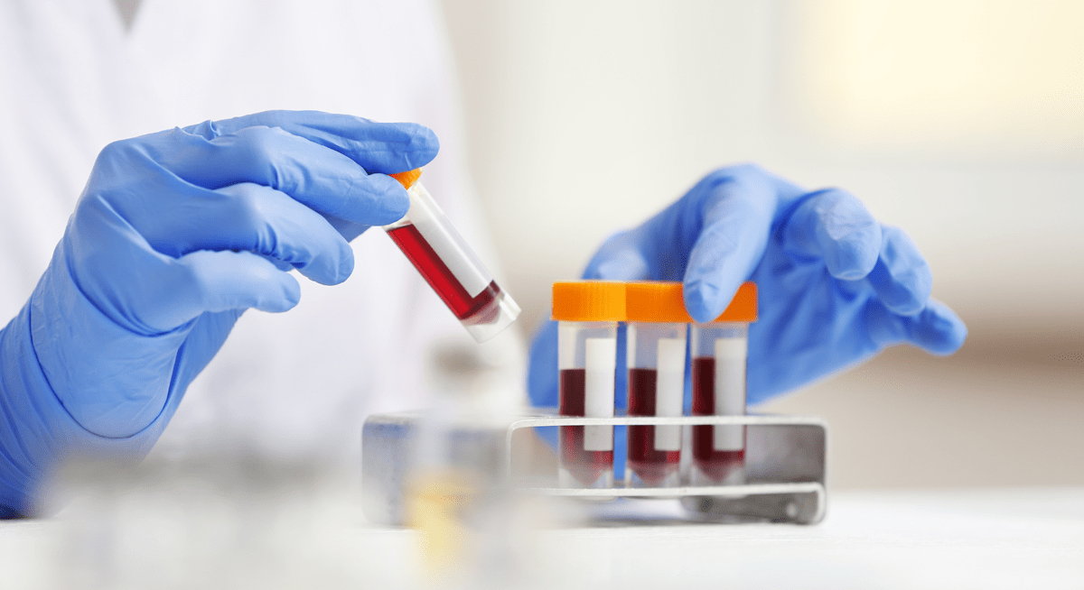 Synlogic and Caldera Therapeutics Announce Merger and $278 Million Private Placement
