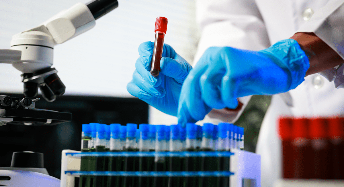 Profusa Signs Term Sheet for Diagnostics Acquisition and Announces Leadership Changes