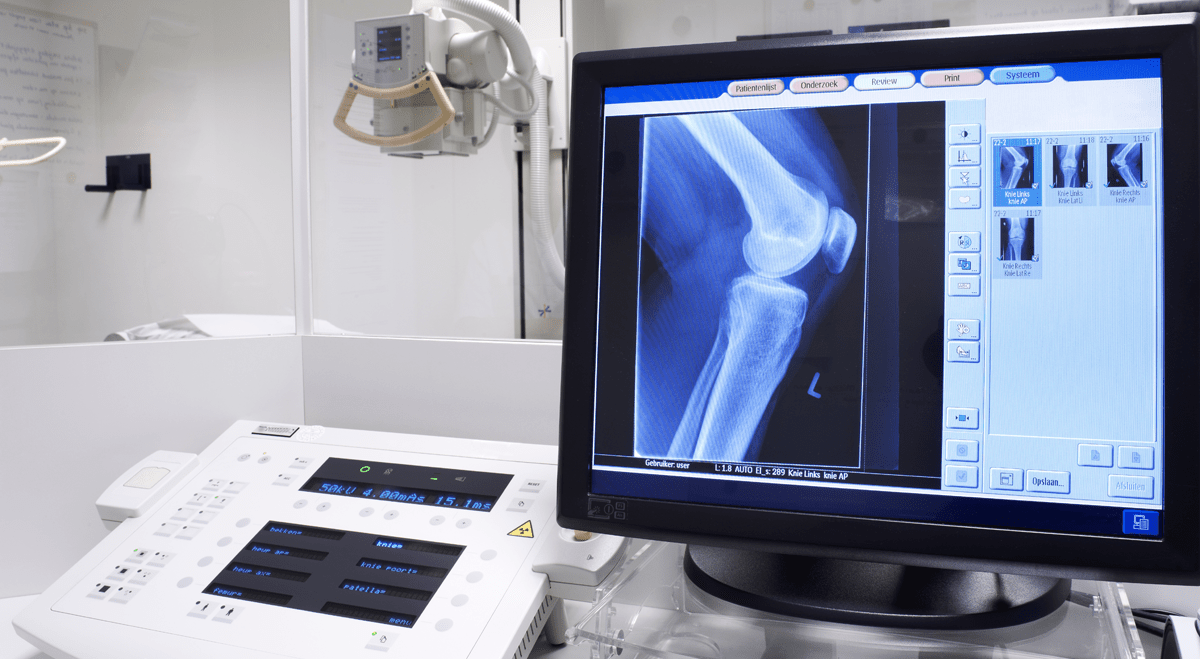 SU Group Exclusive X-Ray Distribution Rights Expand Into Industrial Inspection